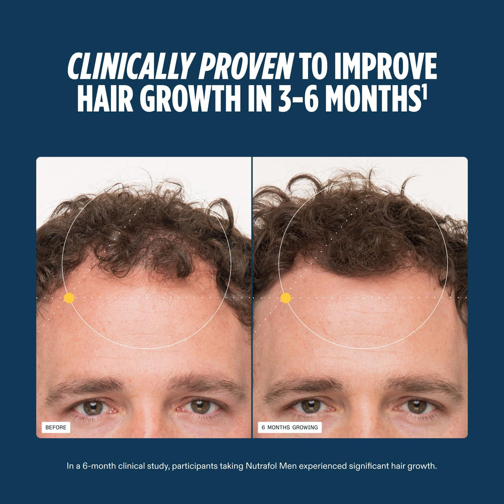 Nutrafol Men Hair Growth Supplements, Ages 18-49, 1-Month Bottle | #1 Dermatologist-Recommended Hair Growth Supplement Brand, Clinically Tested for Visibly Thicker Hair and Scalp Coverage