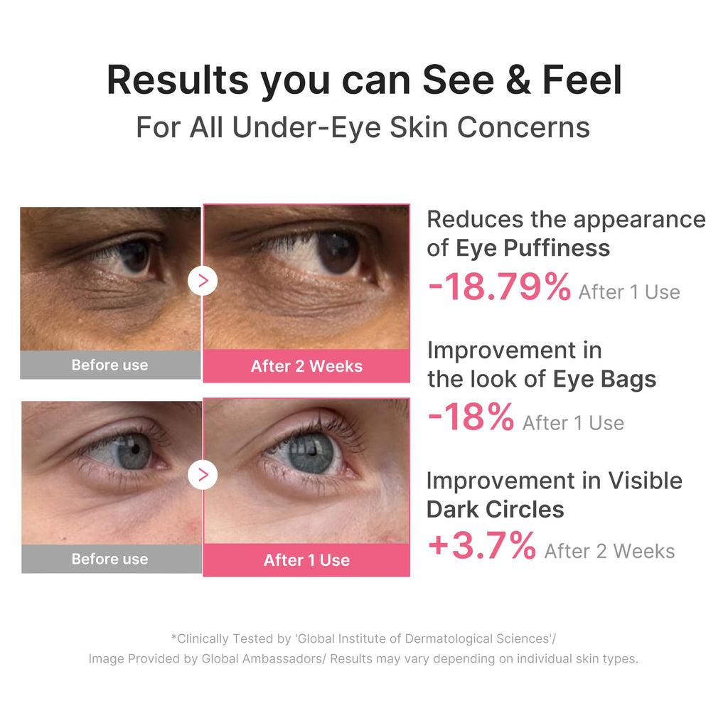 medicube Hydrogel Eye Patches with PDRN, Caffeine & Collagen (60 Counts) | PDRN Retinol & Collagen Gel Mask - Eye Patches for the appearance of Dark Circles, Undereye Bags & Firming, Korean Skincare
