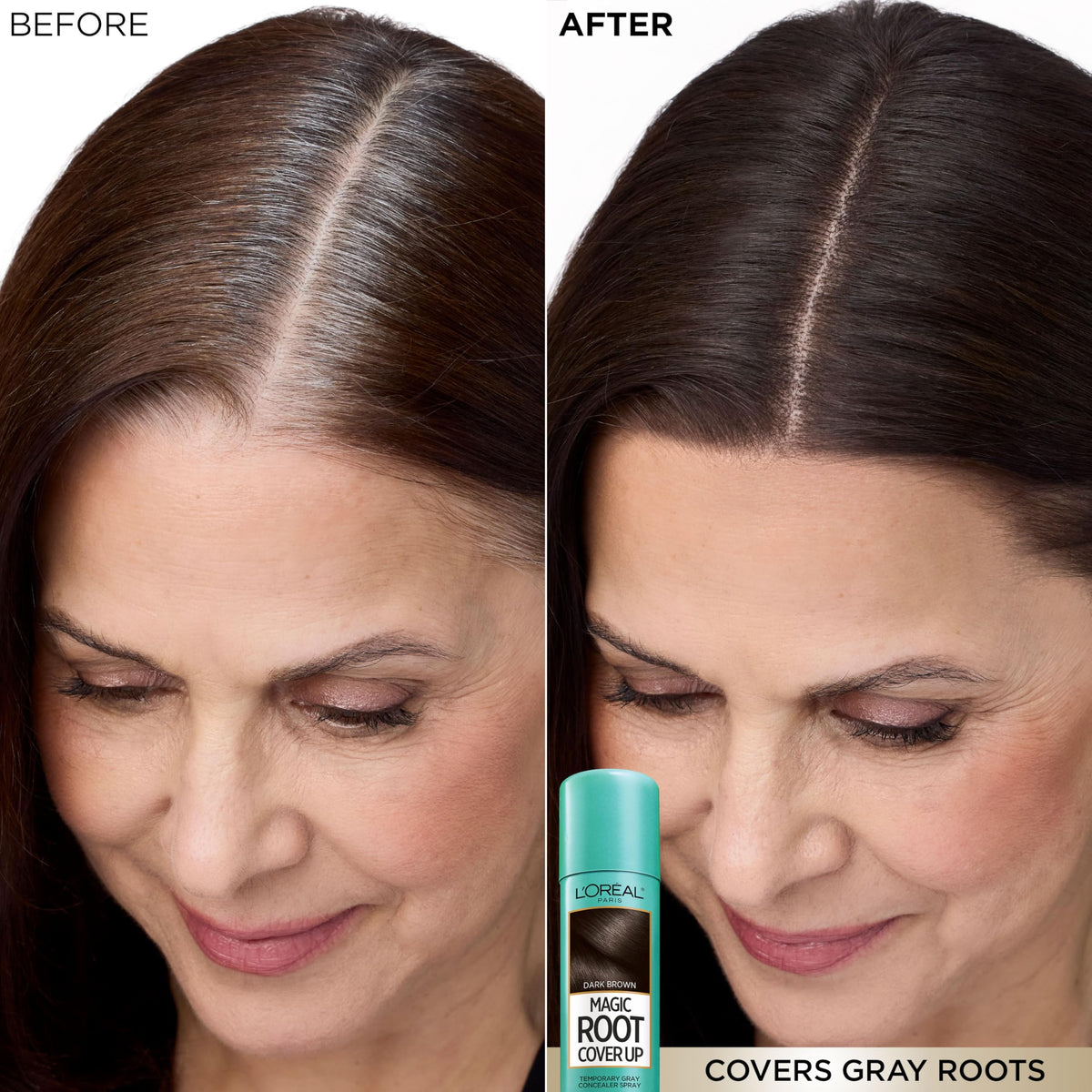 L'Oreal Paris Magic Root Gray Hair Cover Up, Dark Blonde, 2 oz | 100% Gray Hair Coverage with Buildable, Lightweight, and Transfer-Resistant Spray, Temporary Formula, Ammonia-Free