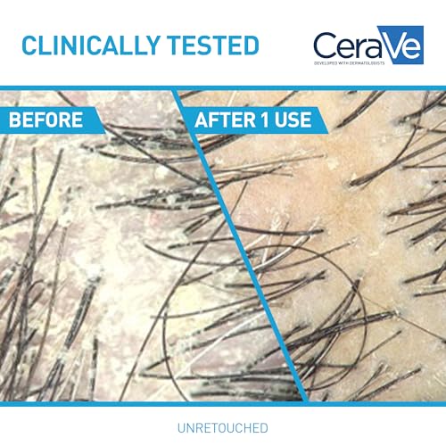 CeraVe Hydrating Anti Dandruff Shampoo, Itchy Scalp Treatment, 12oz | Helps Eliminate Flakes with 1% Pyrithione Zinc, Hyaluronic Acid, Niacinamide and Ceramides In A Sulfate Free Formula