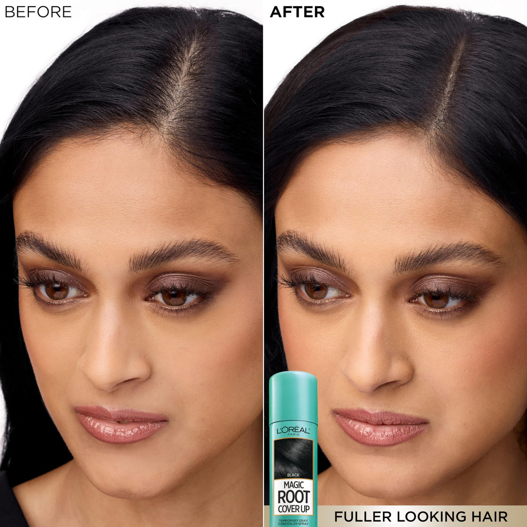 L'Oreal Paris Magic Root Gray Hair Cover Up, Dark Blonde, 2 oz | 100% Gray Hair Coverage with Buildable, Lightweight, and Transfer-Resistant Spray, Temporary Formula, Ammonia-Free