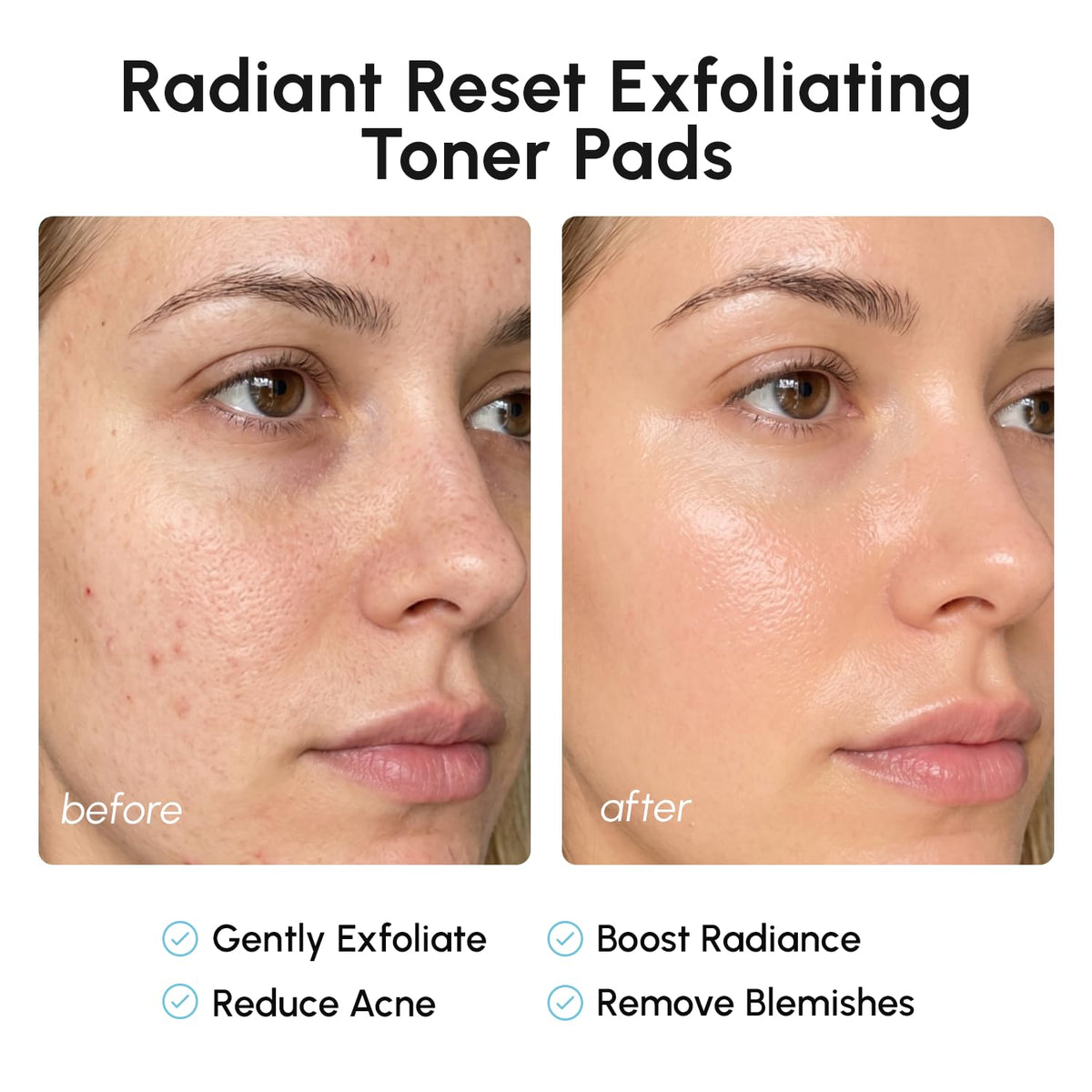 MAREE Glycolic Acid Toner Pads - Face Pads for Exfoliating Peel Zero Pore | Glycolic acid pads, sun spot remover for face, exfoliating face pads with glycolic acid and salicylic acid, acne wipes