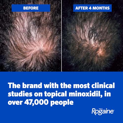 Men's Rogaine 5% Minoxidil Topical Foam, Unscented, 3 x 2.11 oz | Hair Regrowth Foam, Topical Hair Loss Treatment for Men, Regrow Fuller, Thicker Hair, Unscented, Aerosol, 3-Month Supply