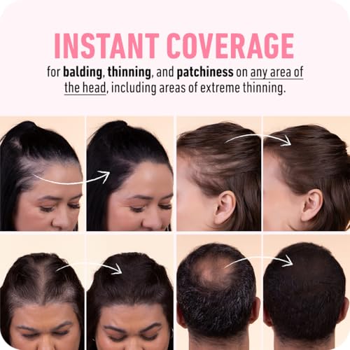 Boldify Hairline Powder, Root Touch Up Hair Color Dark Brown 4g | Instantly Fills Thinning Hair & Sparse Hairlines - Root Cover Up for Gray Hair - Water-Resistant, Sweat-Proof 24-Hour Wear