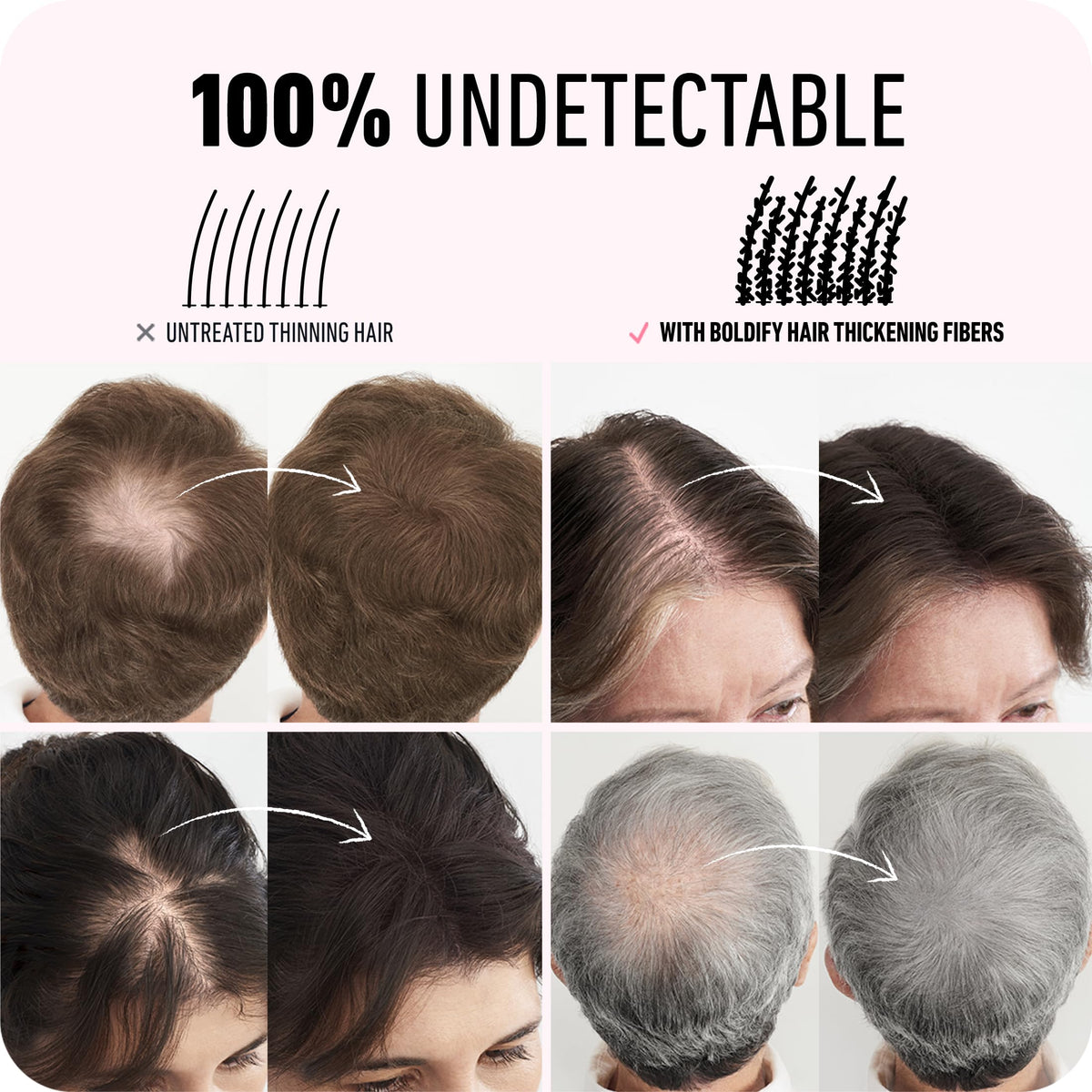 BOLDIFY Hair Fibers for Thinning Hair, for Women & Men, Dark Brown 28g