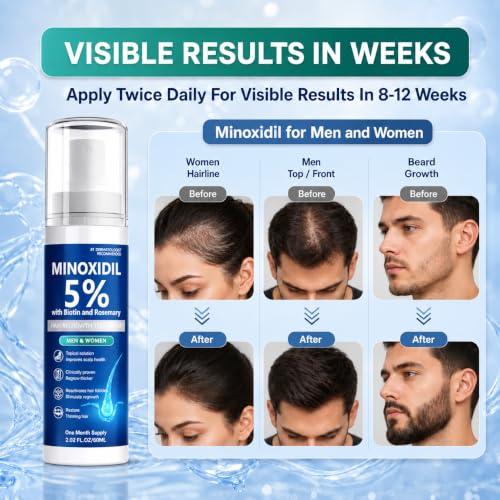 Minoxidil for Men and Women, Hair Growth Serum with Biotin, Rosemary and Batana for Hair Beard Regrowth Treatments Extra Strength Hair Loss Solution, Clinically Proven to Regrow Thicker, 60ML
