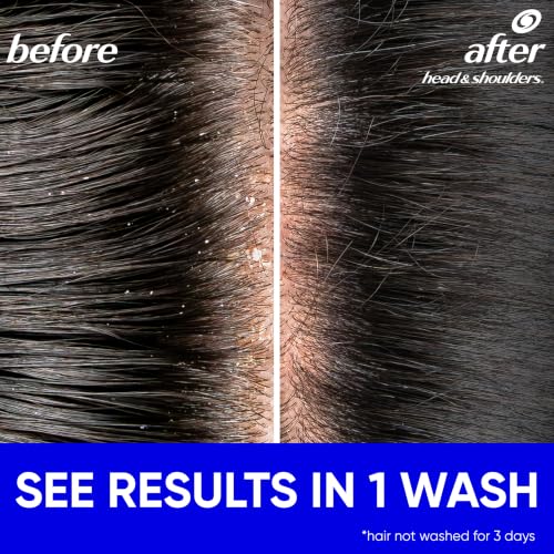 Head & Shoulders Classic Clean Anti-Dandruff Shampoo, 72-Hour Dandruff Protection, 1% Pyrithione Zinc, 28.2 fl oz