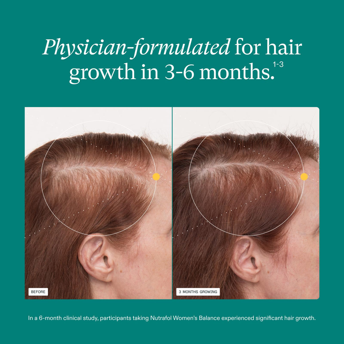 Nutrafol Women's Balance Hair Growth Supplements, Age 45+, 1-Month Pouch