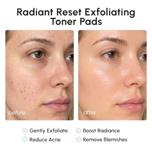 MAREE Glycolic Acid Toner Pads - Face Pads for Exfoliating Peel Zero Pore | Glycolic acid pads, sun spot remover for face, exfoliating face pads with glycolic acid and salicylic acid, acne wipes
