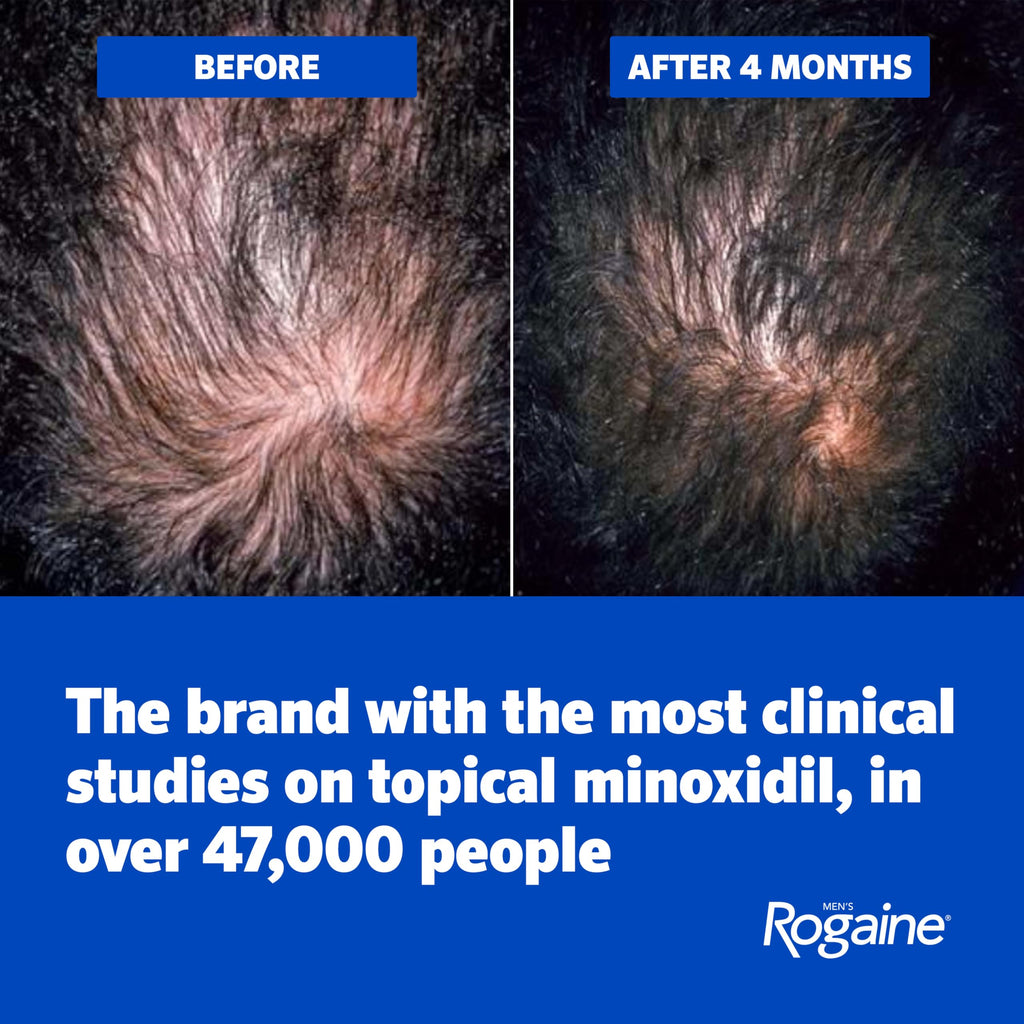 Men's Rogaine 5% Minoxidil Topical Foam, Unscented, 3 x 2.11 oz | Hair Regrowth Foam, Topical Hair Loss Treatment for Men, Regrow Fuller, Thicker Hair, Unscented, Aerosol, 3-Month Supply