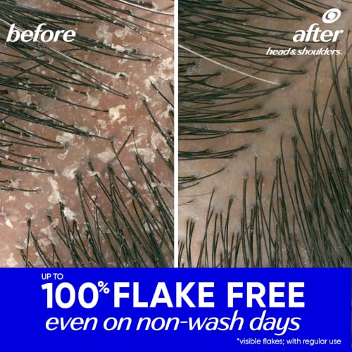 Head & Shoulders Classic Clean Anti-Dandruff Shampoo, 72-Hour Dandruff Protection, 1% Pyrithione Zinc, 28.2 fl oz