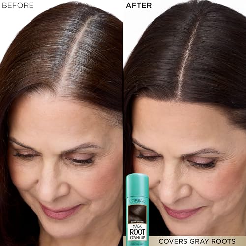 L'Oreal Paris Magic Root Gray Hair Cover Up, Dark Blonde, 2 oz | 100% Gray Hair Coverage with Buildable, Lightweight, and Transfer-Resistant Spray, Temporary Formula, Ammonia-Free